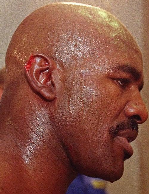 Hace 24 años Tyson le arrancó un pedazo de oreja a Holyfield.