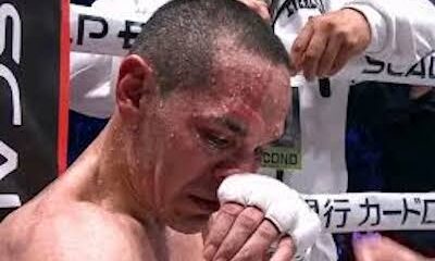 Estrada terminó con dos costillas fracturadas